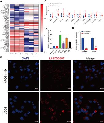 Silencing of Long Non-Coding RNA LINC00607 Prevents Tumor Proliferation of Osteosarcoma by Acting as a Sponge of miR-607 to Downregulate E2F6